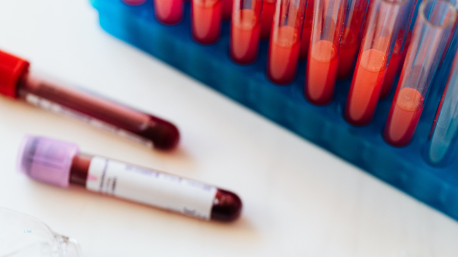 İmmünolojik Analizlerin Zirvesi: Temelden Uzmanlığa ELISA Tekniği ve Uygulamaları