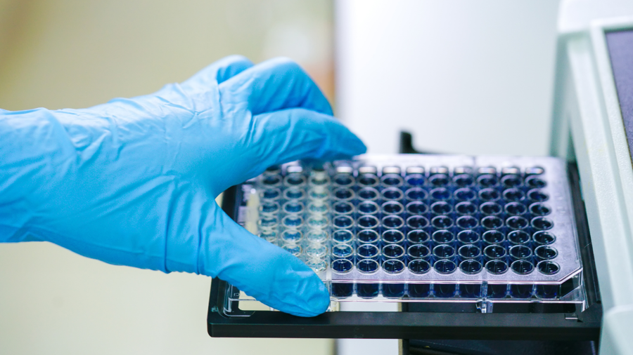 Modern İmmünolojinin Temel Taşı: ELISA (Enzyme-Linked Immunosorbent Assay) Yönteminin Biyokimyası ve Metodolojik Derinliği