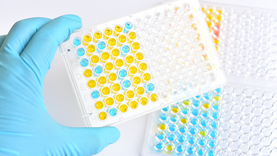 Endüstrinin Gözünden ELISA: Neden Sadece "Bilmek" Yetmez, "Uygulamayı Anlamak" Gerekir?